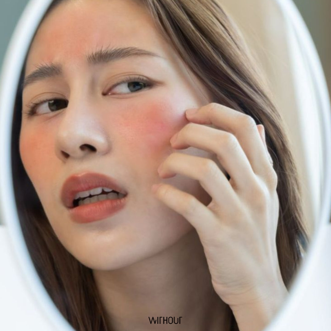 Sensitive Skin Problem Understanding Sensitive Skin: Causes, Triggers, and How to Care for It ...