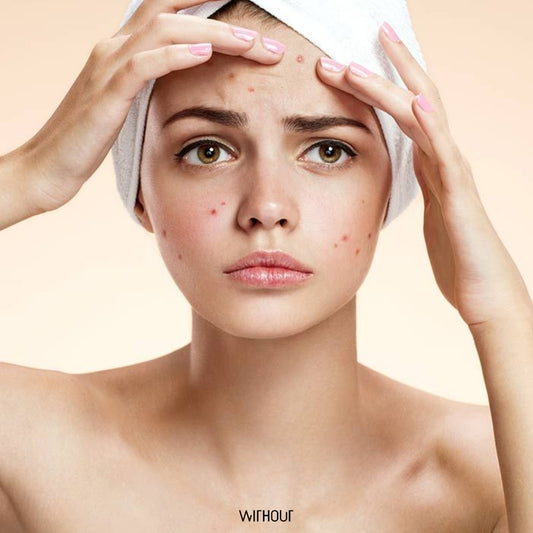 The Secret to Healthy Skin: Simplify Your Skincare Routine